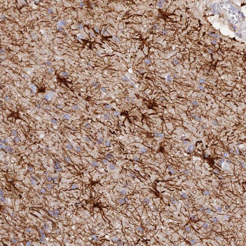 Staining of human cerebral cortex shows strong cytoplasmic positivity in glial cells.