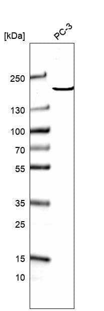 Analysis in human cell line PC-3.