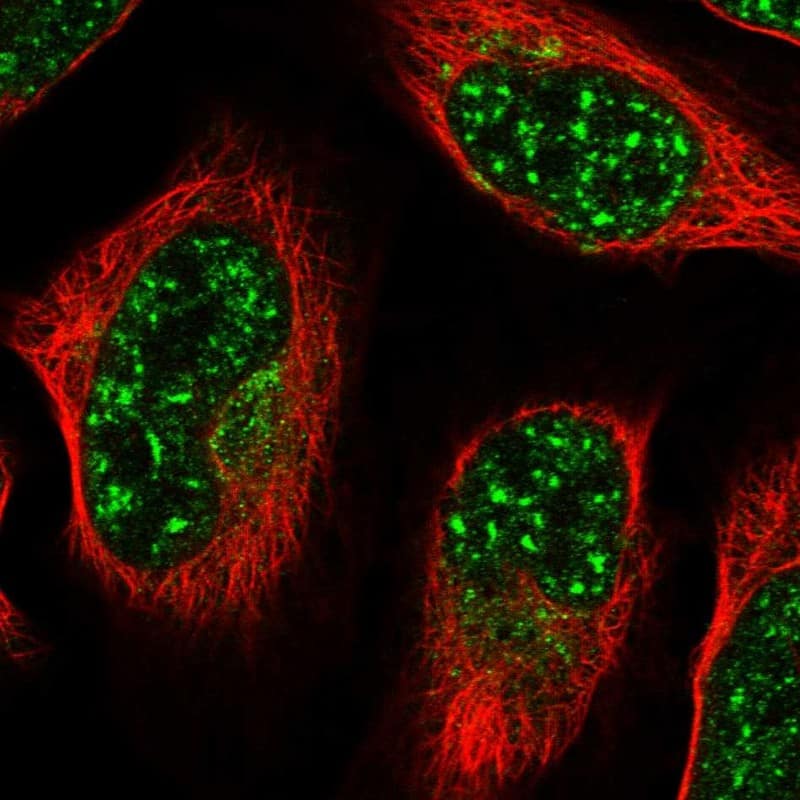 Immunocytochemistry/ Immunofluorescence ZNF527 Antibody - BSA Free