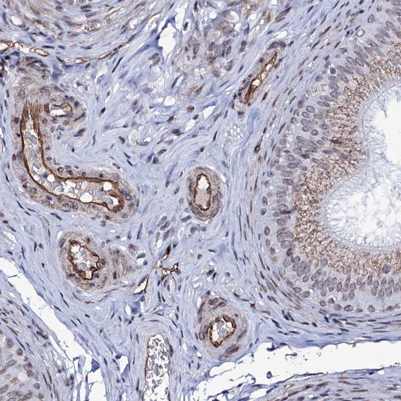 Immunohistochemistry-Paraffin ZC3H12C Antibody - BSA Free