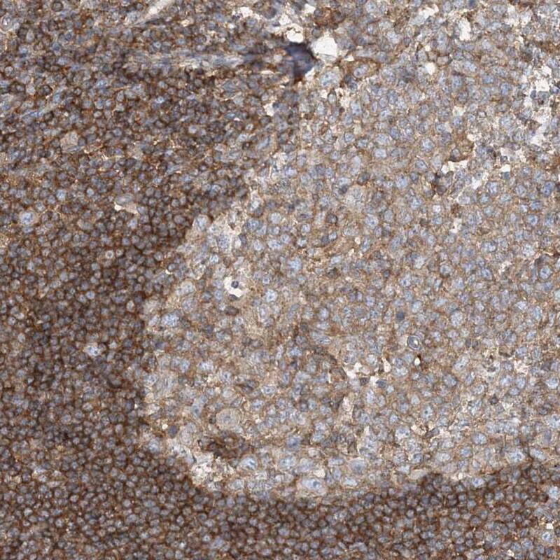 Staining of human appendix shows cytoplasmic positivity in lymphoid tissue.