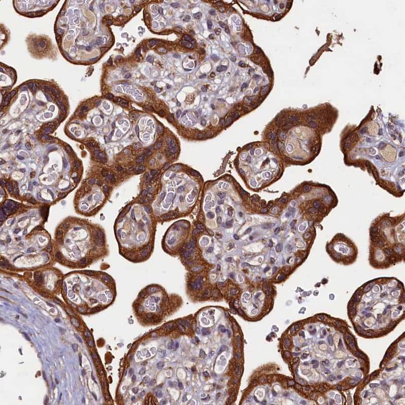 Staining of human placenta shows strong cytoplasmic positivity in trophoblastic cells.
