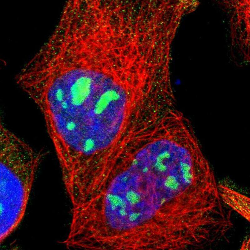 Staining of human cell line A-431 shows localization to nucleoli.