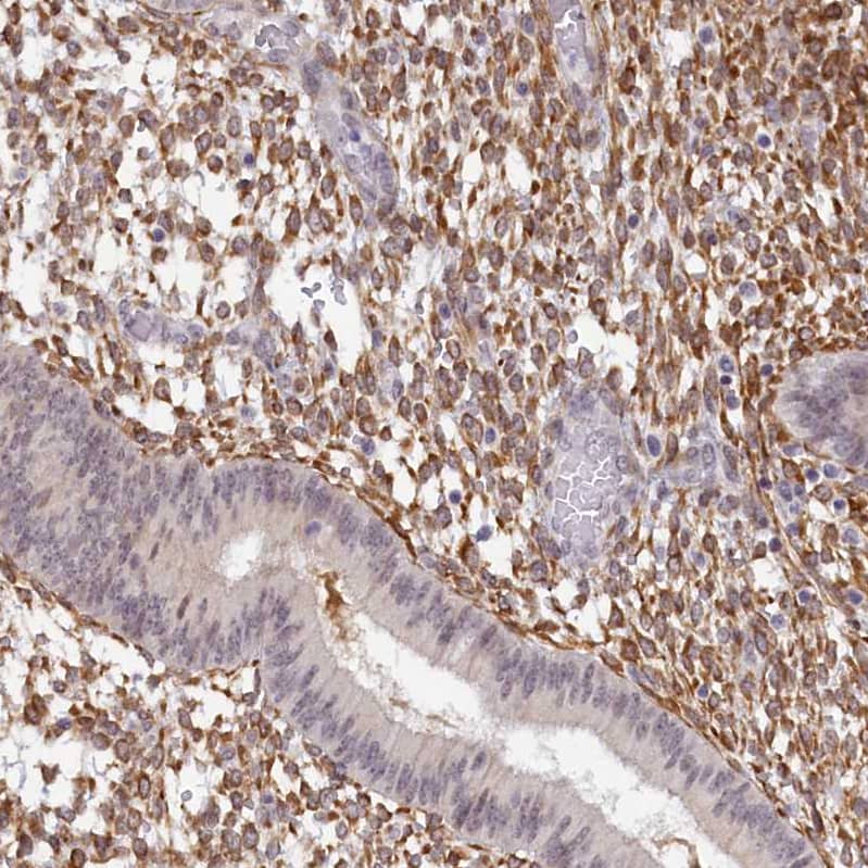 Staining of human endometrium shows strong cytoplasmic positivity in stromal cells.