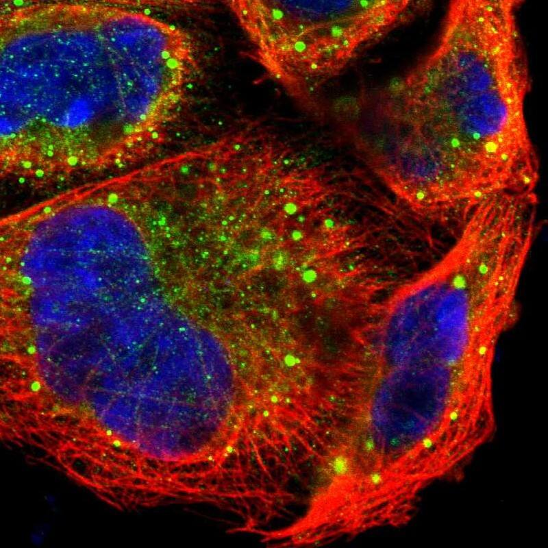 Staining of human cell line A-431 shows localization to cytosol & vesicles.