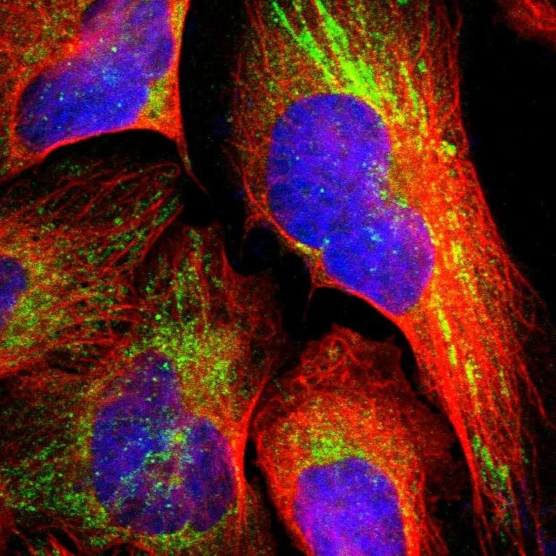 Staining of human cell line U-2 OS shows localization to mitochondria.