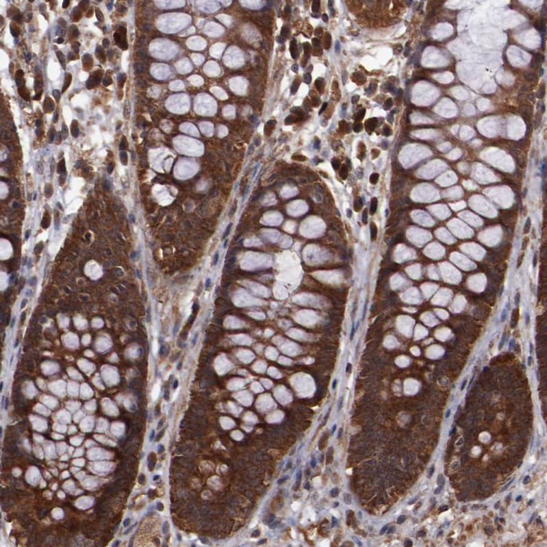 Staining of human rectum shows strong cytoplasmic positivity in glandular cells.