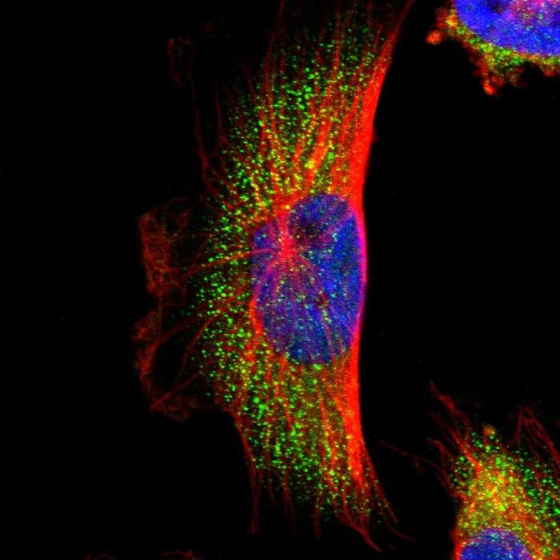 Staining of human cell line U-251 MG shows localization to cytosol.