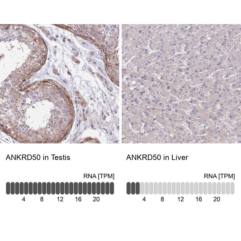 Analysis in human testis and liver tissues using NBP1-93594 antibody. Corresponding ANKRD50 RNA-seq data are presented for the same tissues.