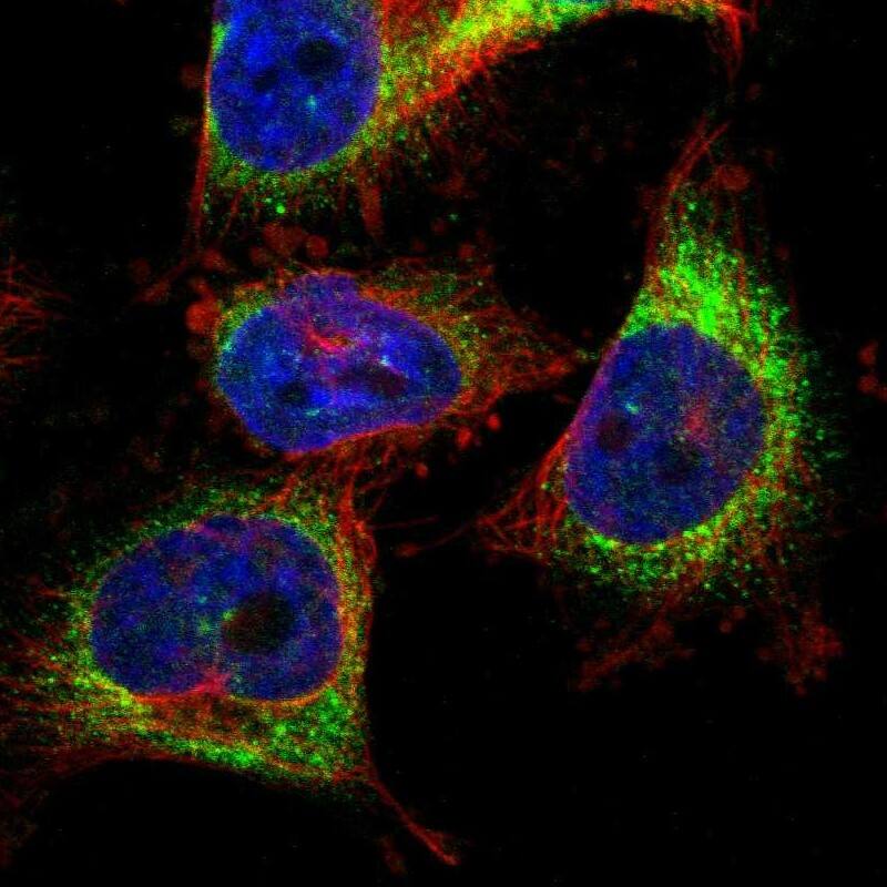 Staining of human cell line U-251 MG shows localization to endoplasmic reticulum.