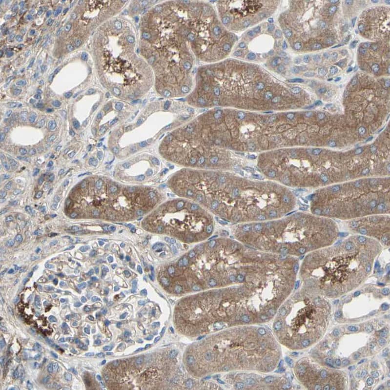 Staining of human kidney shows moderate cytoplasmic positivity in cells in tubules.