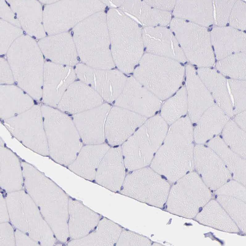 Staining of human skeletal muscle shows no positivity in myocytes as expected.