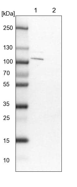 Lane 1: NIH-3T3 cell lysate (Mouse embryonic fibroblast cells)Lane 2: NBT-II cell lysate (Rat Wistar bladder tumour cells)