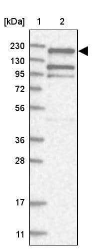 Lane 1: Marker [kDa] 230, 130, 95, 72, 56, 36, 28, 17, 11Lane 2: Human cell line RT-4