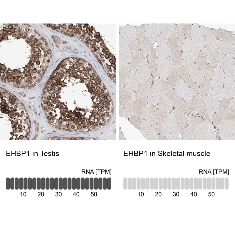 Analysis in human testis and skeletal muscle tissues using NBP1-93614 antibody. Corresponding EHBP1 RNA-seq data are presented for the same tissues.