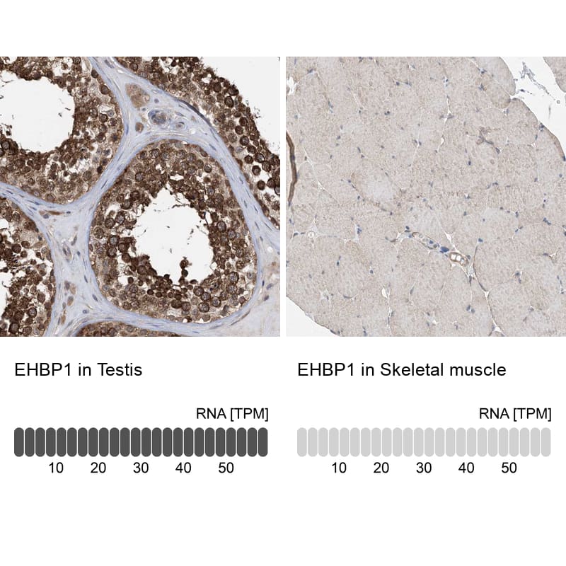 Immunohistochemistry EHBP1 Antibody - BSA Free
