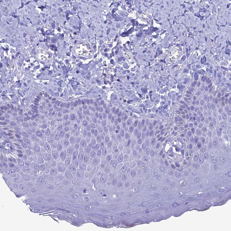 Staining of human skin shows no positivity in squamous epithelial cells as expected.
