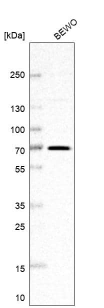 Analysis in human cell line BEWO.