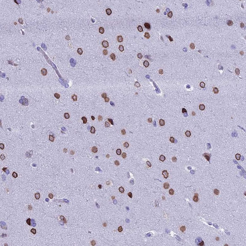 Staining of human cerebral cortex shows strong nuclear membrane positivity in neuronal cells.