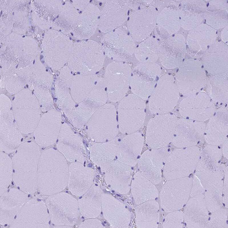 Staining of human skeletal muscle shows no positivity in myocytes as expected.