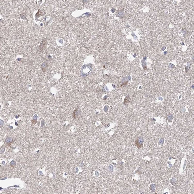 Immunohistochemistry-Paraffin ARHGAP44 Antibody - BSA Free