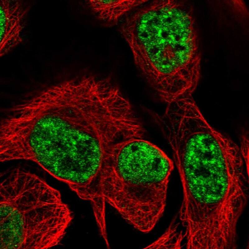Immunocytochemistry/ Immunofluorescence TBC1D12 Antibody - BSA Free