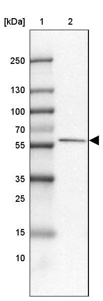 Lane 1: Marker [kDa] 250, 130, 100, 70, 55, 35, 25, 15, 10Lane 2: Human Liver tissue