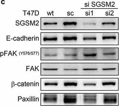 SGSM2 silencing affected T47D cell adhesion and cell migration. (a) The efficiency of SGSM2 knockdown was determined by western blotting (upper panel); sc (scramble), si1, si2, and si3 SGSM2 stable cell lines were collected by G418 selection. The lower panel shows the adhesion abilities of different stable cell lines plated on three types (fibronectin, type I collagen, and type IV collagen; 1 μg/ml) of ECM proteins. Wt indicates wild-type T47D cells. (b) Cell migration abilities of four types (wt, sc, si1, si2) of T47D cells were examined with wound-healing assays; left panels show the cell migration states at 0, 24, and 48 hours. Hoechst was used to stain the nuclei. The average number of migrated cells is presented in the right panel. (c) The protein levels of E-cadherin,  beta -catenin, Paxillin, FAK, SRC, Snail, and Twist were detected by western blotting in wt, sc, si1, and si2 T47D cells.  beta -Actin-1, 2, 3, 4 served as the internal controls. P-values were determined with Student’s t-test; **P  3). Image collected and cropped by CiteAb from the following open publication (//pubmed.ncbi.nlm.nih.gov/30744493), licensed under a CC-BY license. Not internally tested by Novus Biologicals.