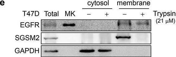 Trypsin-EDTA-digested SGSM2 protein on the cell membrane in the T47D breast cancer cell line. (a) T47D cells were treated with different concentrations (0, 0.21, 2.1, 21, 210, or 2100 nM) of trypsin-EDTA for 3 minutes; bottom graphs show different cell morphologies after trypsin-EDTA treatment (5x, scale bar: 250 μm). (b) SGSM2, E-cadherin, and SGSM3 protein expression changes were observed in 11 adherent breast cell lines and a human melanoma cell line (MDA-MB-435s) after treatment with or without trypsin-EDTA (21 μM). (c) T47D cells were treated with trypsin-EDTA (1X; 21 μM) for subculture, and then, SGSM2, E-cadherin, and SGSM3 protein levels were observed at different time points (0, 3, 6, 9, 12, and 24 hours) after cell seeding. (d) Cytosol and membrane extracts were examined to confirm SGSM2 protein localization after 21 nM trypsin-EDTA treatment, and (e) higher (21 μM) trypsin-EDTA concentrations were further examined. ‘Total’, representing total protein, which was the positive control, was extracted after cell seeding for 48 hours. GAPDH and EGFR were used as the positive cytosol and membrane controls, respectively.  alpha -Tubulin served as the internal control for western blotting. Image collected and cropped by CiteAb from the following open publication (//pubmed.ncbi.nlm.nih.gov/30744493), licensed under a CC-BY license. Not internally tested by Novus Biologicals.