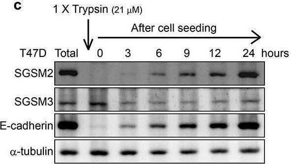 Trypsin-EDTA-digested SGSM2 protein on the cell membrane in the T47D breast cancer cell line. (a) T47D cells were treated with different concentrations (0, 0.21, 2.1, 21, 210, or 2100 nM) of trypsin-EDTA for 3 minutes; bottom graphs show different cell morphologies after trypsin-EDTA treatment (5x, scale bar: 250 μm). (b) SGSM2, E-cadherin, and SGSM3 protein expression changes were observed in 11 adherent breast cell lines and a human melanoma cell line (MDA-MB-435s) after treatment with or without trypsin-EDTA (21 μM). (c) T47D cells were treated with trypsin-EDTA (1X; 21 μM) for subculture, and then, SGSM2, E-cadherin, and SGSM3 protein levels were observed at different time points (0, 3, 6, 9, 12, and 24 hours) after cell seeding. (d) Cytosol and membrane extracts were examined to confirm SGSM2 protein localization after 21 nM trypsin-EDTA treatment, and (e) higher (21 μM) trypsin-EDTA concentrations were further examined. ‘Total’, representing total protein, which was the positive control, was extracted after cell seeding for 48 hours. GAPDH and EGFR were used as the positive cytosol and membrane controls, respectively.  alpha -Tubulin served as the internal control for western blotting. Image collected and cropped by CiteAb from the following open publication (//pubmed.ncbi.nlm.nih.gov/30744493), licensed under a CC-BY license. Not internally tested by Novus Biologicals.
