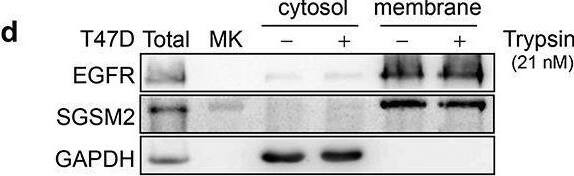 Trypsin-EDTA-digested SGSM2 protein on the cell membrane in the T47D breast cancer cell line. (a) T47D cells were treated with different concentrations (0, 0.21, 2.1, 21, 210, or 2100 nM) of trypsin-EDTA for 3 minutes; bottom graphs show different cell morphologies after trypsin-EDTA treatment (5x, scale bar: 250 μm). (b) SGSM2, E-cadherin, and SGSM3 protein expression changes were observed in 11 adherent breast cell lines and a human melanoma cell line (MDA-MB-435s) after treatment with or without trypsin-EDTA (21 μM). (c) T47D cells were treated with trypsin-EDTA (1X; 21 μM) for subculture, and then, SGSM2, E-cadherin, and SGSM3 protein levels were observed at different time points (0, 3, 6, 9, 12, and 24 hours) after cell seeding. (d) Cytosol and membrane extracts were examined to confirm SGSM2 protein localization after 21 nM trypsin-EDTA treatment, and (e) higher (21 μM) trypsin-EDTA concentrations were further examined. ‘Total’, representing total protein, which was the positive control, was extracted after cell seeding for 48 hours. GAPDH and EGFR were used as the positive cytosol and membrane controls, respectively.  alpha -Tubulin served as the internal control for western blotting. Image collected and cropped by CiteAb from the following open publication (//pubmed.ncbi.nlm.nih.gov/30744493), licensed under a CC-BY license. Not internally tested by Novus Biologicals.