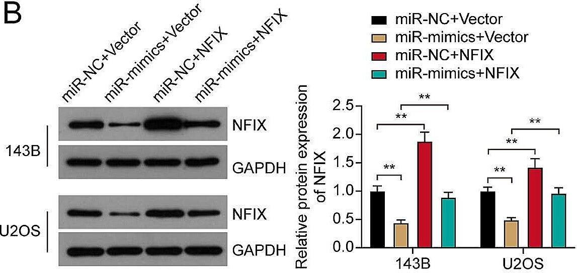 NFIX neutralized the effects of miR-744-5p on osteosarcoma cells. (A) Protein expression of NFIX in OS cells transfected with NFIX overexpression vector. (B) Protein expression of NFIX in different groups of OS cells. (C) OS cell viability was assessed by CCK-8 assay. (D) Cell proliferation was visualized by colony formation assay. (E) Flow cytometry assay was performed to determine cell apoptosis rate. (F) The viability of HUVECs was assessed by CCK-8 assay. (G) The effects of miR-744-5p and NFIX on the tube formation of HUVECs were detected by tube formation assay. *P < 0.05; ** P < 0.01 Image collected and cropped by CiteAb from the following open publication (//josr-online.biomedcentral.com/articles/10.1186/s13018-024-04947-x), licensed under a CC-BY license. Not internally tested by Novus Biologicals.