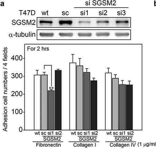 SGSM2 silencing affected T47D cell adhesion and cell migration. (a) The efficiency of SGSM2 knockdown was determined by western blotting (upper panel); sc (scramble), si1, si2, and si3 SGSM2 stable cell lines were collected by G418 selection. The lower panel shows the adhesion abilities of different stable cell lines plated on three types (fibronectin, type I collagen, and type IV collagen; 1 μg/ml) of ECM proteins. Wt indicates wild-type T47D cells. (b) Cell migration abilities of four types (wt, sc, si1, si2) of T47D cells were examined with wound-healing assays; left panels show the cell migration states at 0, 24, and 48 hours. Hoechst was used to stain the nuclei. The average number of migrated cells is presented in the right panel. (c) The protein levels of E-cadherin,  beta -catenin, Paxillin, FAK, SRC, Snail, and Twist were detected by western blotting in wt, sc, si1, and si2 T47D cells.  beta -Actin-1, 2, 3, 4 served as the internal controls. P-values were determined with Student’s t-test; **P  3). Image collected and cropped by CiteAb from the following open publication (//pubmed.ncbi.nlm.nih.gov/30744493), licensed under a CC-BY license. Not internally tested by Novus Biologicals.