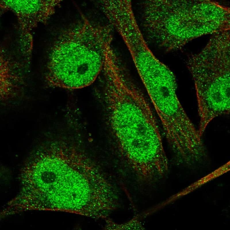 Staining of human cell line U-251 MG shows localization to nucleoplasm & cytosol.