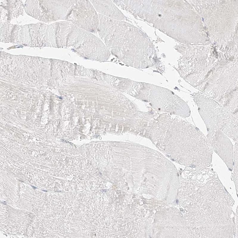 Staining of human skeletal muscle shows no positivity in myocytes as expected.