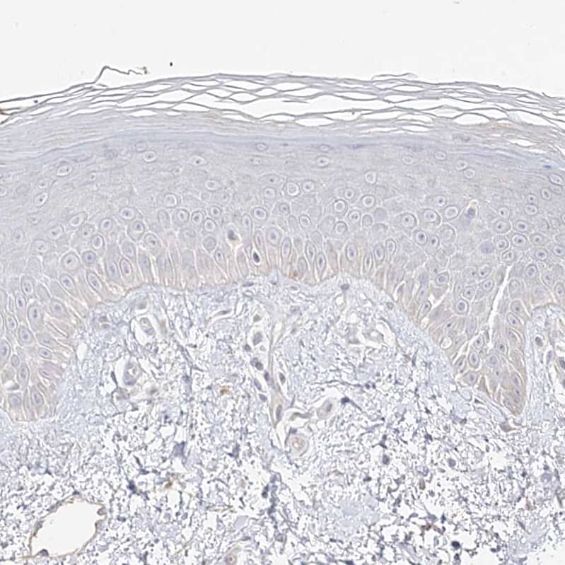 Staining of human skin shows no positivity in squamous epithelial cells as expected.