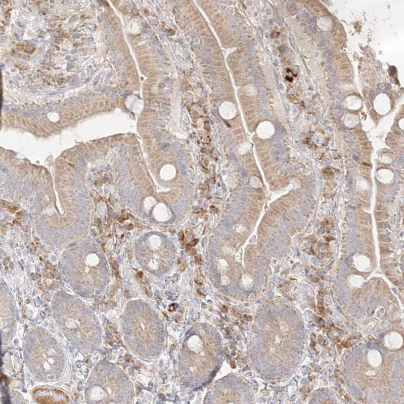 Staining of human duodenum shows moderate cytoplasmic positivity in lymphoid cells.