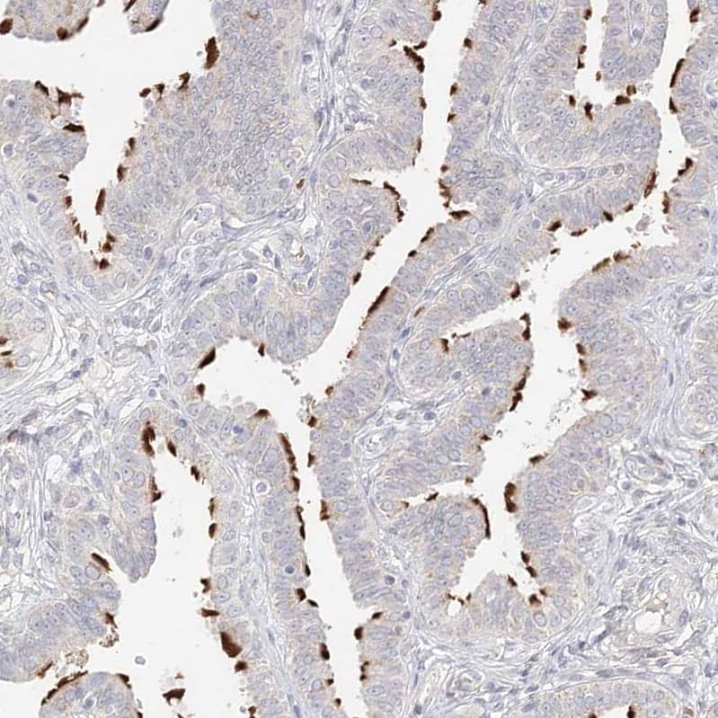 Staining of human Fallopian tube shows strong positivity in cilia in glandular cells.