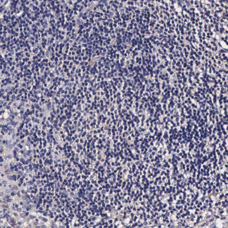 Immunohistochemistry TECPR2 Antibody - BSA Free