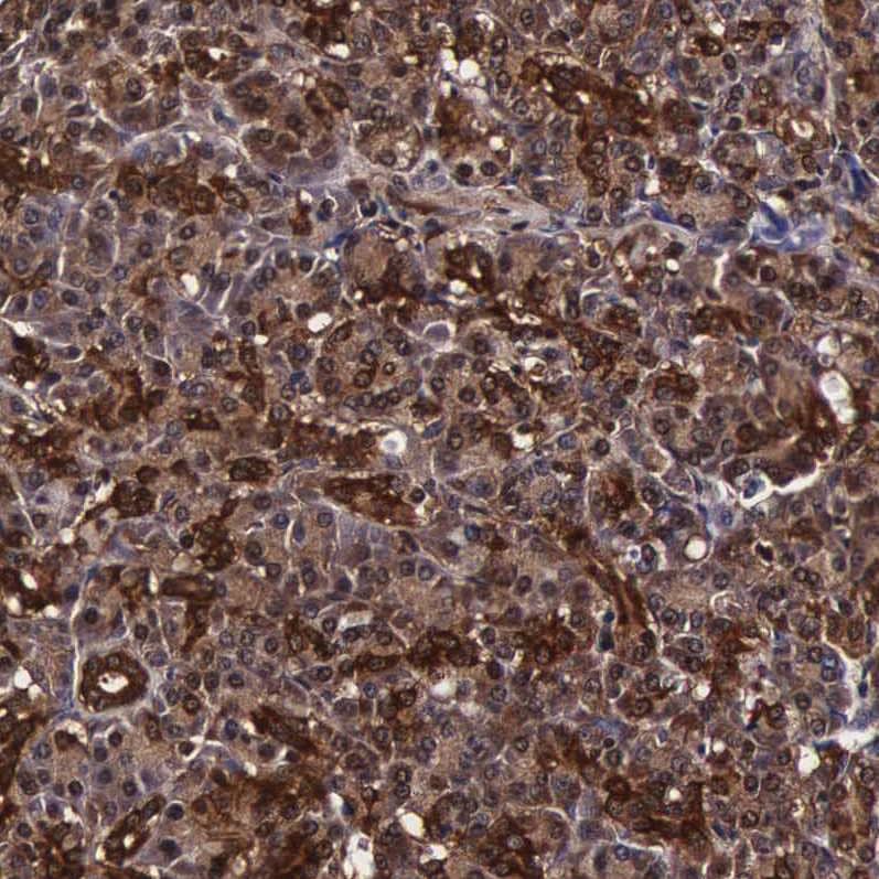 Immunohistochemistry TECPR2 Antibody - BSA Free