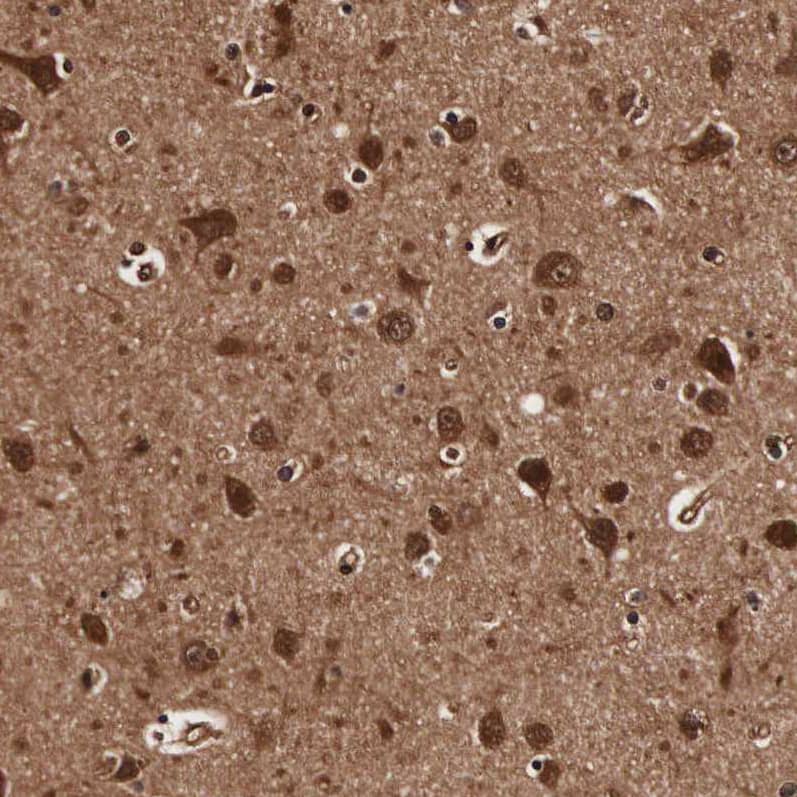 Immunohistochemistry TECPR2 Antibody - BSA Free