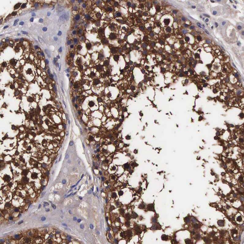 Immunohistochemistry TECPR2 Antibody - BSA Free