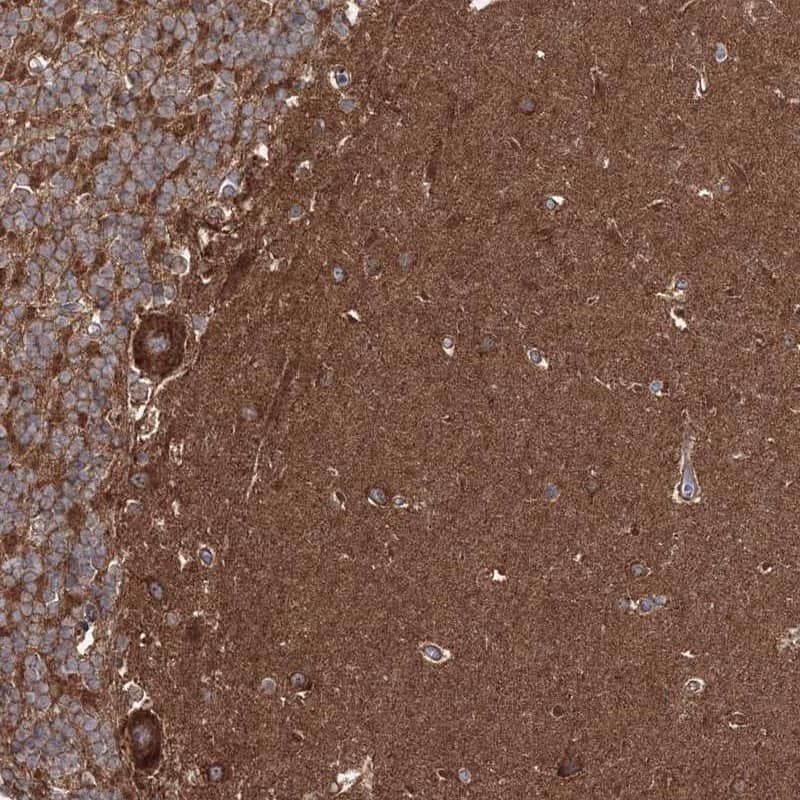 Staining of human cerebellum shows strong cytoplasmic positivity in Purkinje cells and neuropil was distinctly stained. .