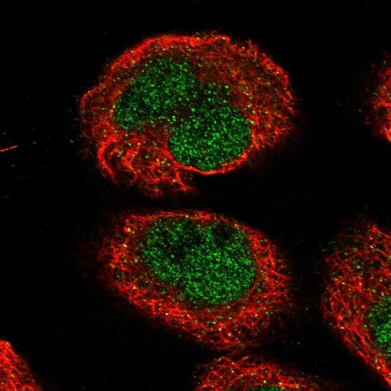 Immunocytochemistry/ Immunofluorescence TMEM194A Antibody - BSA Free