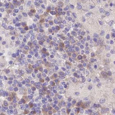Staining of human lymph node using Anti-FAM168B antibody NBP1-93650.