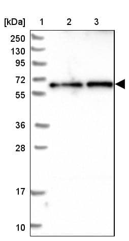Lane 1: Marker [kDa] 250, 130, 95, 72, 55, 36, 28, 17, 10Lane 2: Human cell line RT-4Lane 3: Human cell line U-251MG sp