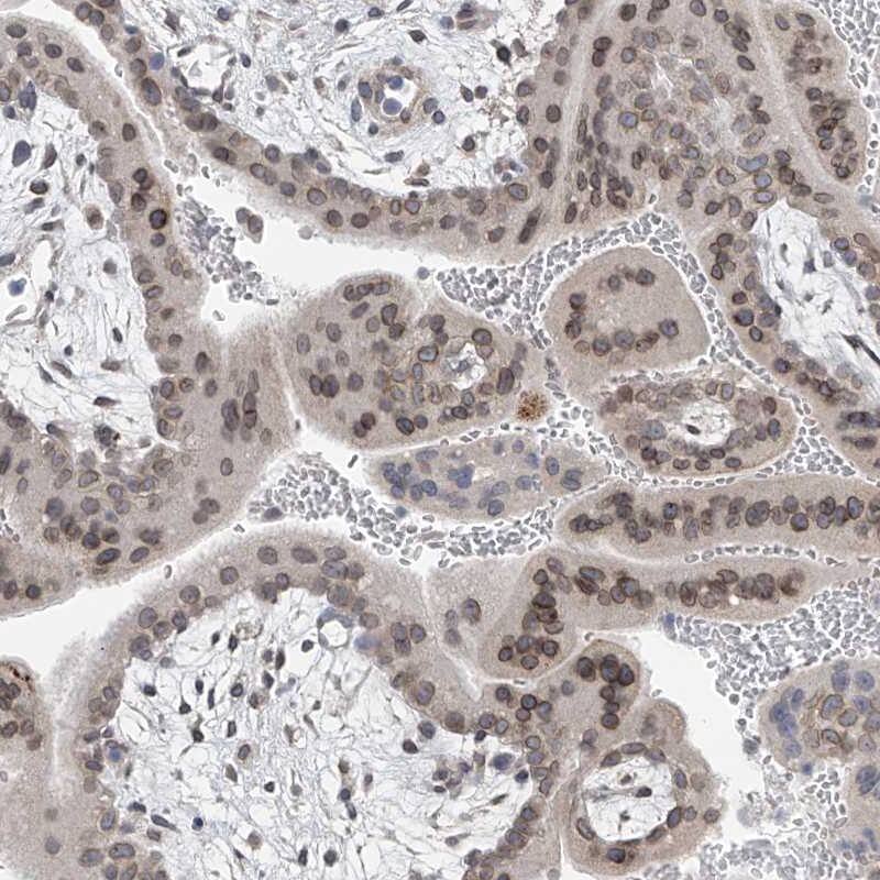 Staining of human placenta shows distinct nuclear membranous positivity in trophoblastic cells.