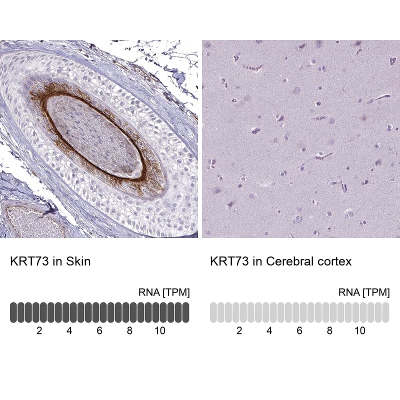 Immunohistochemistry-Paraffin KRT73 Antibody
