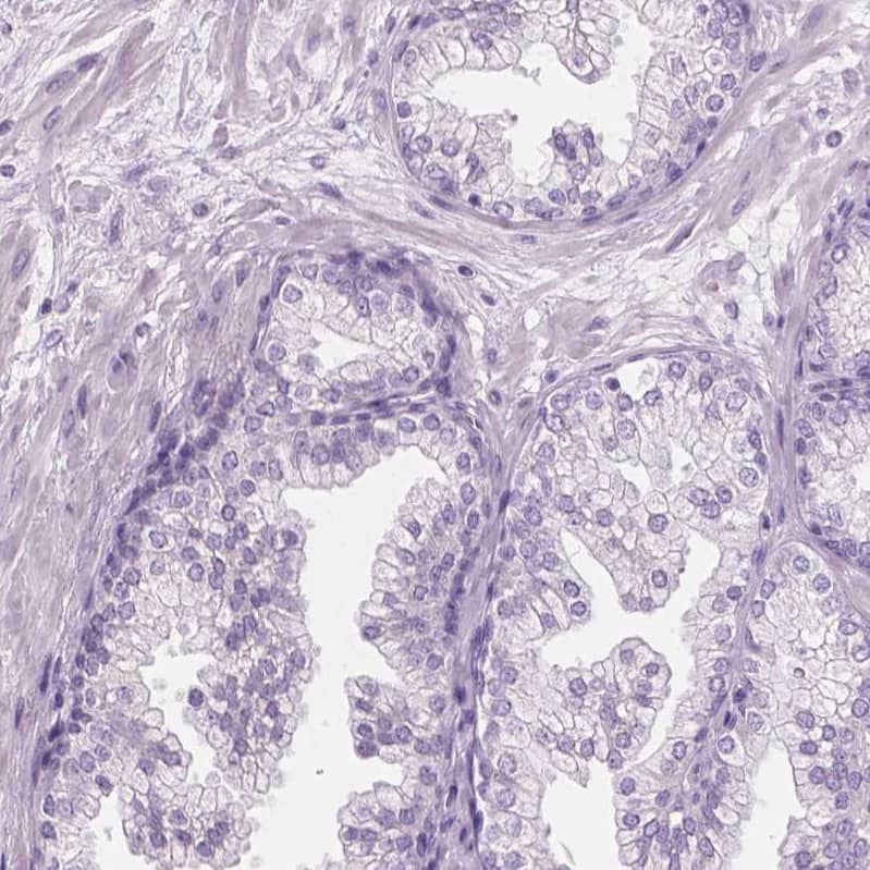 Staining of human prostate shows no positivity in glandular cells as expected.