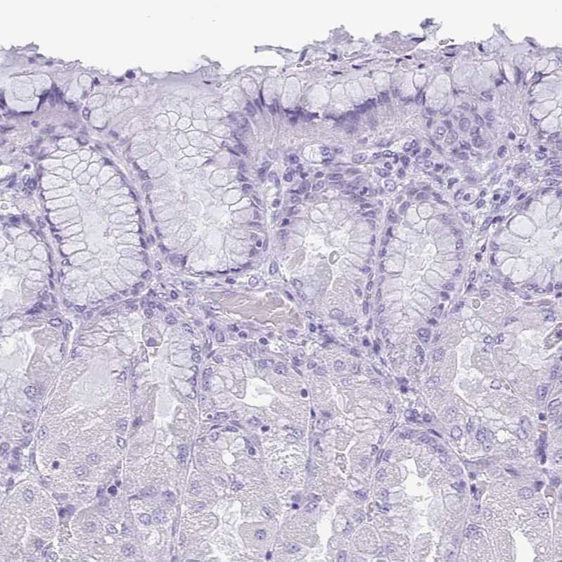 Immunohistochemistry-Paraffin KRT78 Antibody - BSA Free